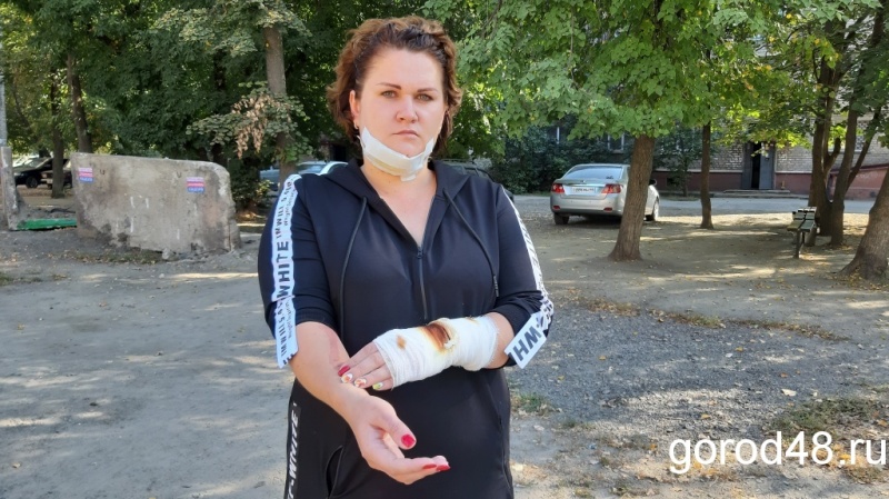 Полиция возбудила дело по факту выстрела из ракетницы в лицо многодетной матери Полиция возбудила дело по факту выстрела из ракетницы в лицо многодетной матери