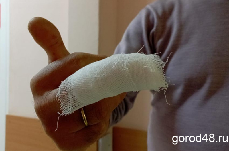 «Шёл и не заметил, как мне оторвало палец» - удивительный случай на улице Катукова