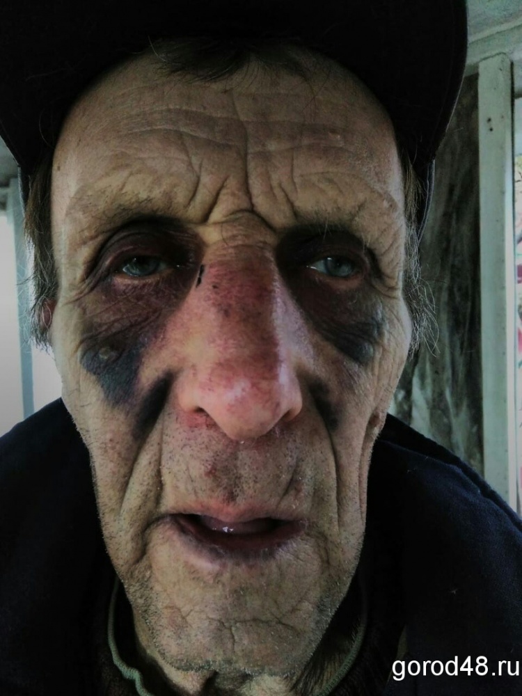 78-летнего водителя жестко избили у Центрального рынка 78-летнего водителя жестко избили у Центрального рынка