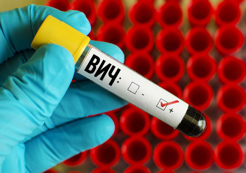 В январе 25 жителей области заразились ВИЧ В январе 25 жителей области заразились ВИЧ
