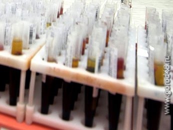 С начала года в области выявлено 90 ВИЧ-инфицированных С начала года в области выявлено 90 ВИЧ-инфицированных