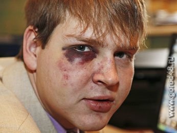 Дело о нападении на кандидата в депутаты городского Совета Липецка взял под личный контроль вице-спикер Государственной Думы Дело о нападении на кандидата в депутаты городского Совета Липецка взял под личный контроль вице-спикер Государственной Думы