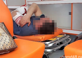 Липчанину пришили отрезанную циркулярной пилой руку  