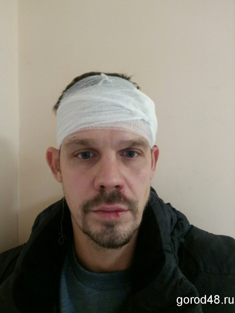 Полиция отказалась возбуждать уголовное дело по нападению на защитника дольщиков Полиция отказалась возбуждать уголовное дело по нападению на защитника дольщиков