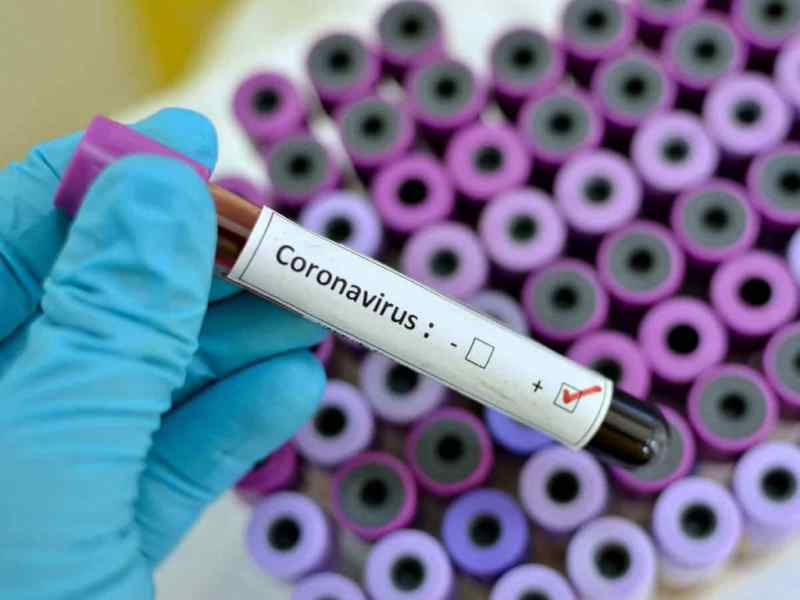 Война с вирусом: от COVID-19 погибли уже 100 000 человек, США готовятся к сильнейшему в истории спаду экономики Война с вирусом: от COVID-19 погибли уже 100 000 человек, США готовятся к сильнейшему в истории спаду экономики