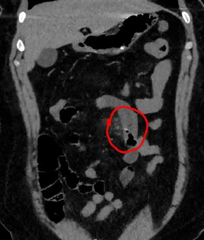 D6F71DEF-6FFD-4165-B1FA-5AD48332C588.webp D6F71DEF-6FFD-4165-B1FA-5AD48332C588.webp